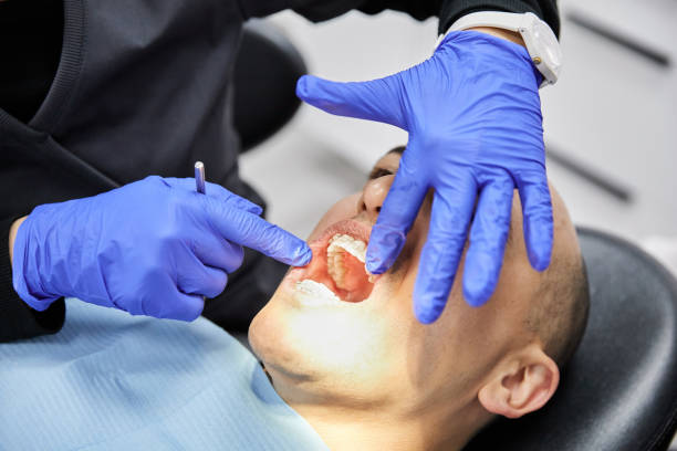 Best Walk-In Emergency Dentist in East Patchogue, NY
